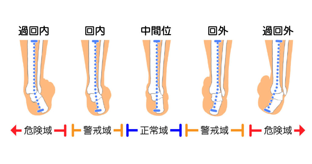 足の回内