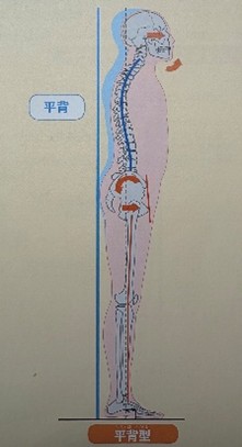 平背型(引用元:姿勢の教科書/著者:竹井 仁/出版:ナツメ社)