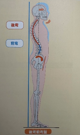 後弯前弯型(引用元:姿勢の教科書/著者:竹井 仁/出版:ナツメ社)