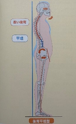 後弯平坦型(引用元:姿勢の教科書/著者:竹井 仁/出版:ナツメ社)