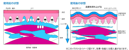 キネシオテーピング 公式 みやはた鍼灸整骨院 京都市 開院20年の実績
